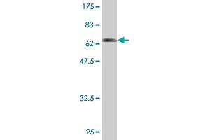 Western Blot detection against Immunogen (63. (CAPG anticorps  (AA 1-348))
