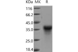 Western Blotting (WB) image for C-Type Lectin Domain Family 5, Member A (CLEC5A) protein (His tag) (ABIN7321165)