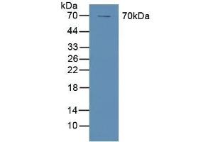 Detection of COX-1 in Human A431 Cells using Polyclonal Antibody to Cyclooxygenase 1 (COX-1) (PTGS1 anticorps  (AA 367-599))