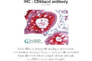 Image no. 2 for anti-Carcinoembryonic Antigen-Related Cell Adhesion Molecule 1/3/6 (CEACAM1/3/6) antibody (ABIN1723246) (CD66acd anticorps)