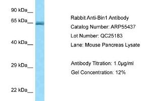 Western Blotting (WB) image for anti-Bridging Integrator 1 (BIN1) (Middle Region) antibody (ABIN2786209) (BIN1 anticorps  (Middle Region))