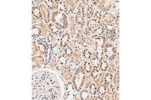 anti-NADPH Oxidase 1 (NOX1) (AA 243-271) antibody