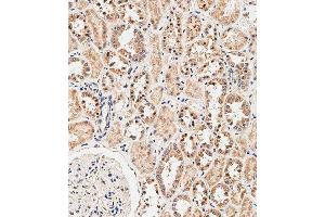 Immunohistochemical analysis of paraffin-embedded human kidney tissue using C performed on the Leica® BOND RXm. (NOX1 anticorps  (AA 243-271))