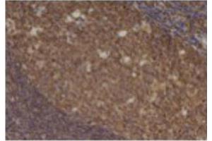 Image no. 3 for anti-Chemokine (C-C Motif) Ligand 5 (CCL5) antibody (ABIN465158) (CCL5 anticorps)