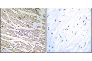 Immunohistochemistry analysis of paraffin-embedded human heart tissue, using LAMA4 Antibody.