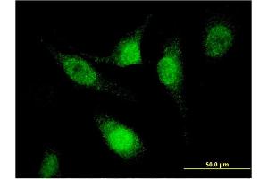 Immunofluorescence of monoclonal antibody to SFRS12 on HeLa cell. (SFRS12 anticorps  (AA 443-508))
