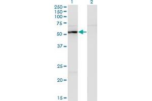 Western Blot analysis of UAP1 expression in transfected 293T cell line by UAP1 monoclonal antibody (M01), clone 3A9. (UAP1 anticorps  (AA 406-504))