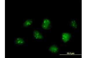 Immunofluorescence of  purified  MaxPab antibody to IFRD2 on HeLa cell. (IFRD2 anticorps  (AA 1-442))