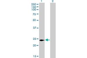 Western Blot analysis of C16orf5 expression in transfected 293T cell line by C16orf5 MaxPab polyclonal antibody. (CDIP1 anticorps  (AA 1-208))