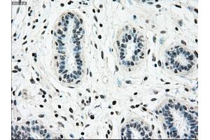 Immunohistochemical staining of paraffin-embedded breast tissue using anti-NRBP1 mouse monoclonal antibody.