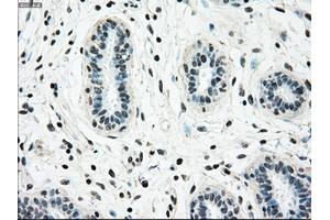 Immunohistochemical staining of paraffin-embedded breast tissue using anti-NRBP1 mouse monoclonal antibody. (NRBP1 anticorps)
