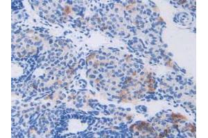 IHC-P analysis of Mouse Ovary Tissue, with DAB staining. (CAPNL1 anticorps  (AA 387-694))