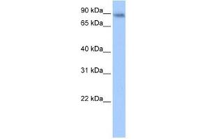 JAKMIP1 antibody used at 0. (JAKMIP1 anticorps  (Middle Region))