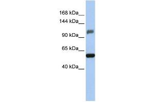 WB Suggested Anti-ZSCAN20 Antibody Titration:  0. (ZSCAN20 anticorps  (Middle Region))