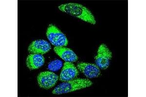 anti-Wilms Tumor 1 (WT1) (AA 346-375) antibody