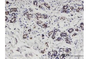 Immunoperoxidase of monoclonal antibody to CCDC115 on formalin-fixed paraffin-embedded human breast. (CCDC115 anticorps  (AA 1-132))