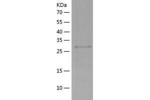 Western Blotting (WB) image for Cytochrome B5 Reductase 1 (CYB5R1) (AA 29-305) protein (His tag) (ABIN7122567) (CYB5R1 Protein (AA 29-305) (His tag))