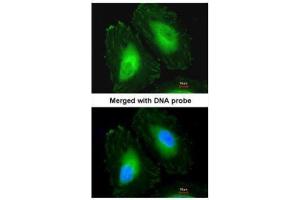 ICC/IF Image Immunofluorescence analysis of paraformaldehyde-fixed HeLa, using Beta-crystallin A4, antibody at 1:200 dilution. (CRYbA4 anticorps)