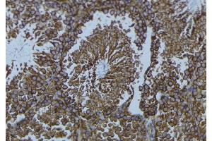 ABIN6276729 at 1/100 staining Mouse testis tissue by IHC-P. (Tryptophan Hydroxylase 1 anticorps  (Internal Region))