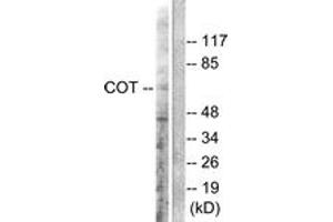 Western Blotting (WB) image for anti-Mitogen-Activated Protein Kinase Kinase Kinase 8 (MAP3K8) (AA 256-305) antibody (ABIN2888594) (MAP3K8 anticorps  (AA 256-305))