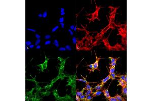 Immunocytochemistry/Immunofluorescence analysis using Rabbit Anti-HSP70 Acetyl Lys77 Polyclonal Antibody (ABIN5650759).