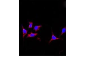 Immunofluorescence (IF) image for anti-SRY (Sex Determining Region Y)-Box 2 (SOX2) antibody (ABIN356387)