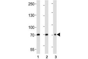 Western blot analysis of lysate from (1) U266, (2) HepG2 cell line, (3) mouse brain tissue lysate using CD73 antibody at 1:2000. (CD73 anticorps  (AA 520-550))