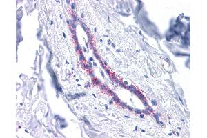 CDH1 antibody was used for immunohistochemistry at a concentration of 4-8 ug/ml. (E-cadherin anticorps)