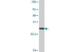 Western Blot detection against Immunogen (38. (RIN2 anticorps  (AA 786-894))