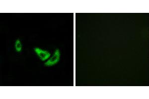 Peptide - +Western blot analysis of extracts from K562 cells, using DCT antibody.