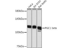 Western blot analysis of extracts of various cell lines, using PGC1 beta Rabbit mAb (ABIN1680494, ABIN3018825, ABIN3018826 and ABIN7101668) at 1:1000 dilution. (PPARGC1B anticorps)