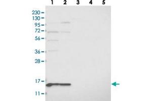 Western blot analysis of Lane 1: RT-4, Lane 2: U-251 MG, Lane 3: Human Plasma, Lane 4: Liver, Lane 5: Tonsil with MRPL41 polyclonal antibody  at 1:250-1:500 dilution. (MRPL41 anticorps)