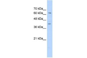 WB Suggested Anti-ZNF415 Antibody Titration:  0. (ZNF415 anticorps  (C-Term))