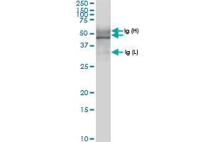 Immunoprecipitation of TUBD1 transfected lysate using anti-TUBD1 MaxPab rabbit polyclonal antibody and Protein A Magnetic Bead , and immunoblotted with TUBD1 MaxPab rabbit polyclonal antibody (D01) .