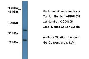 WB Suggested Anti-Clns1a  Antibody Titration: 0. (CLNS1A anticorps  (C-Term))