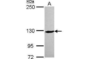 XPC anticorps  (C-Term)