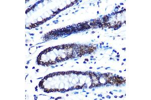 Immunohistochemistry of paraffin-embedded human colon using Lamin B1 Rabbit mAb (ABIN7268180) at dilution of 1:100 (40x lens). (Lamin B1 anticorps)
