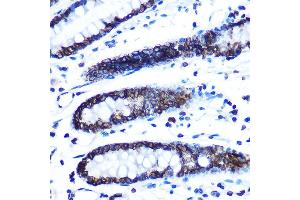 Immunohistochemistry of paraffin-embedded human colon using Lamin B1 Rabbit mAb (ABIN7268180) at dilution of 1:100 (40x lens).