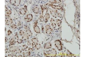 Immunoperoxidase of monoclonal antibody to SMAD1 on formalin-fixed paraffin-embedded human salivary gland tissue.