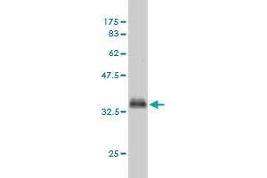 Western Blot detection against Immunogen (37.