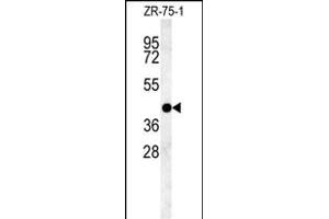 PSG9 Antibody (Center) (ABIN654403 and ABIN2844144) western blot analysis in ZR-75-1 cell line lysates (35 μg/lane). (PSG9 anticorps  (AA 108-137))