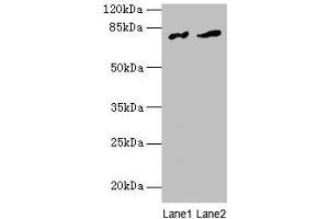 Western blot All lanes: FAM161A antibody at 8 μg/mL Lane 1: Human placenta tissue Lane 2: Mouse liver tissue Secondary Goat polyclonal to rabbit IgG at 1/10000 dilution Predicted band size: 77, 65, 84 kDa Observed band size: 77 kDa (FAM161A anticorps  (AA 1-300))