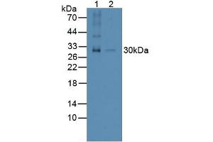 Figure. (RANKL anticorps  (AA 79-247))
