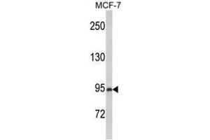 Western blot analysis of PREX1 Antibody (Center) in MCF-7 cell line lysates (35µg/lane). (PREX1 anticorps  (Middle Region))