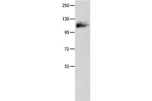 Western Blot analysis of Mouse lung tissue using Amphiphysin I Polyclonal Antibody at dilution of 1:500 (Amphiphysin anticorps)