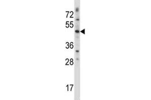 WNT3 antibody western blot analysis in CEM lysate. (WNT3 anticorps  (AA 155-184))