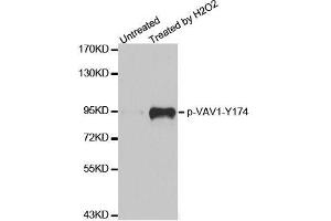 Western blot analysis of extracts from Jurkat cells,using phospho-VAV1-Y174 antibody (ABIN2987533). (VAV1 anticorps  (pTyr174))