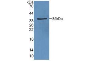 Detection of Recombinant VEGFR2, Rat using Polyclonal Antibody to Vascular Endothelial Growth Factor Receptor 2 (VEGFR2) (VEGFR2/CD309 anticorps  (AA 46-320))