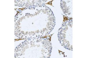 Immunohistochemistry of paraffin-embedded mouse testis using FMOD antibody (ABIN2562633) at dilution of 1:100 (20x lens). (Fibromodulin anticorps)