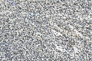 IHC analysis of HOXD11 using anti-HOXD11 antibody (ABIN7603174).